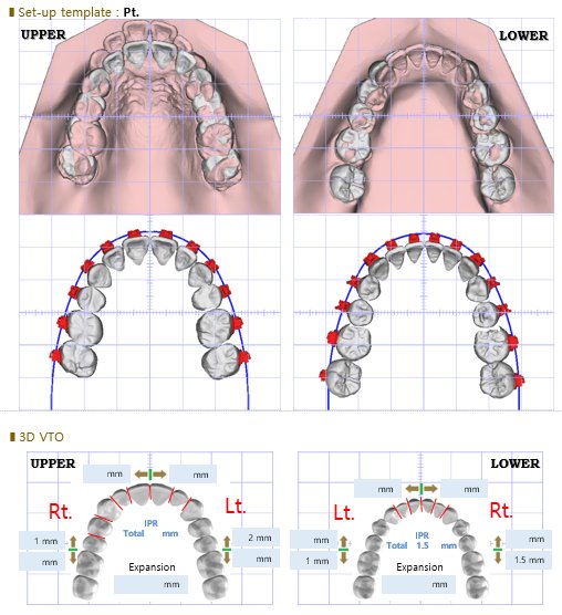 3D VTO 시뮬레이션